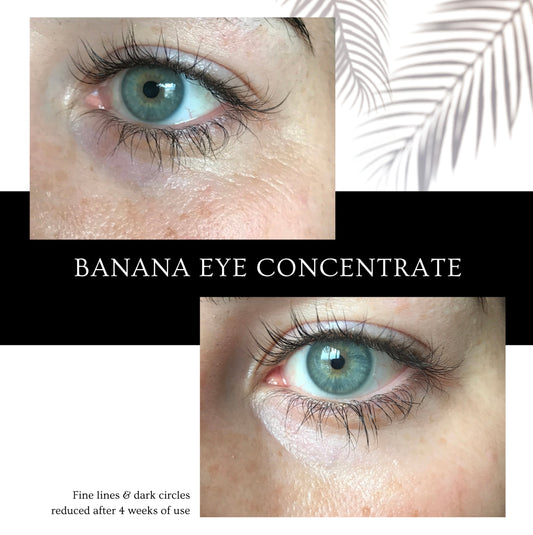 before and after of woman's eyes after using the banana eye concentrate for 4 weeks